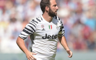 Phát hoảng với thân hình béo ụ của Gonzalo Higuain