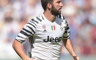 'Higuain trông như một con heo'
