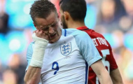 Video: Vardy tự vả vào mặt sao khi bỏ lỡ cơ hội ngon ăn