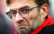 Jurgen Klopp nói gì sau thất bại trước Burnley?