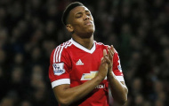 Nguyên nhân nào cho sự xuống dốc của Anthony Martial?