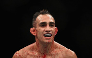 Tony Ferguson bị nghi ngờ mắc bệnh tâm thần, McGregor gửi lời động viên