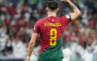 Nghịch lý Bruno Fernandes