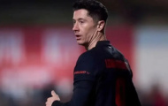 Lewandowski chưa chắc đá trận mở màn La Liga vì chấn thương đùi