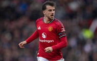 Man United lo lắng trước trận gặp Brighton, Amorim cập nhật tình hình chấn thương
