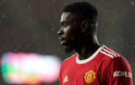 Axel Tuanzebe kiện Man Utd, cáo buộc cẩu thả y tế khiến sự nghiệp bị hủy hoại