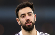 Mất Bruno Fernandes, Manchester United lao đao giữa cơn bão chấn thương