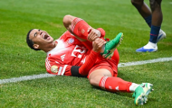 Jamal Musiala bị nghi ngờ gãy chân trong trận tứ kết Club World Cup 2025