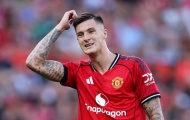 Benjamin Sesko đưa ra lời hứa đanh thép sau thất bại trước Arsenal