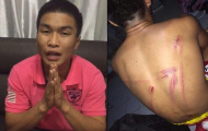 Võ sĩ Muay Thái tố HLV đánh đập tàn nhẫn mình