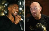 Anthony Joshua mượn Conor McGregor cà khịa Tyson Fury