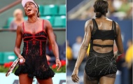Thảm họa thời trang của các sao quần vợt