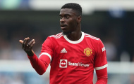 Axel Tuanzebe kiện Man United vì sơ suất y tế nghiêm trọng