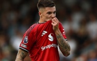 Sesko vẫn chưa thể đá chính ở Manchester United, vì sao?