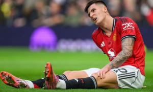 Sesko chấn thương đầu gối, Man Utd mất tân binh vài tuần