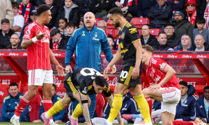 Sean Dyche nhìn thấy tín hiệu tích cực dù Forest chưa thể thắng Man United