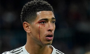 Bellingham đổ máu, Real Madrid nhận 'cơn mưa' thẻ phạt trong thảm bại trước Celta Vigo