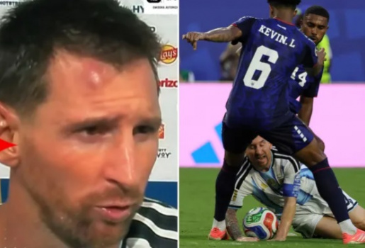 Lionel Messi và vết sưng trên trán sau trận thắng Cape Verde