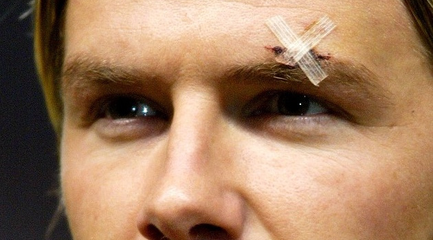 Chiếc giày bay và vết sẹo cuộc đời David Beckham