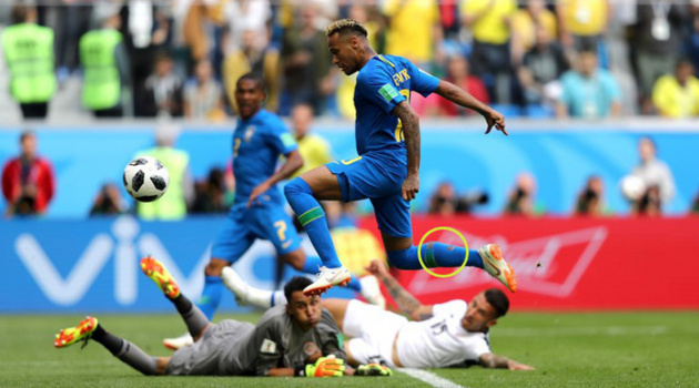 Vì sao Neymar xung trận với chiếc tất rách?