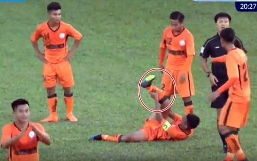 SỐC: Thủ quân U19 SHB Đà Nẵng gãy chân trong trận đấu với HAGL