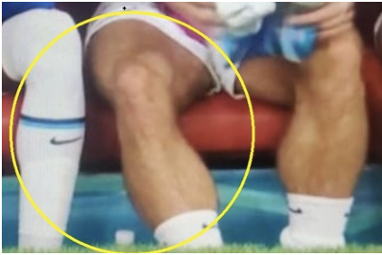 Bắp chân gây chú ý của Grealish