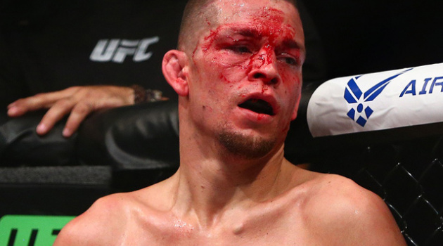 Nate Diaz trở lại hạng cân trên 70kg tại UFC 189