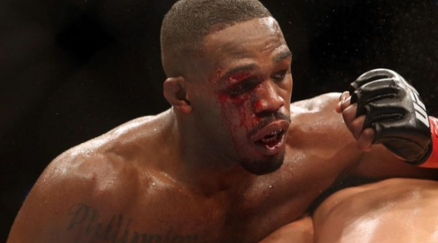 Tổn thương não, nguyên nhân cho hành vi thiếu kiểm soát của Jon Jones?