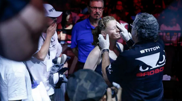 Nếu UFC xin lỗi, 'Stitch' Duran sẽ trở lại