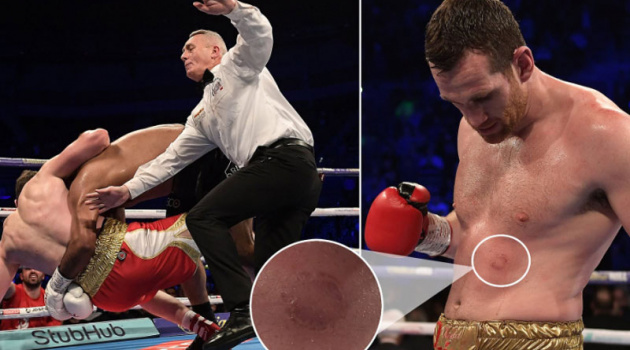 Chơi chiêu cẩu xực, võ sỹ boxing nhận án phạt cực nặng